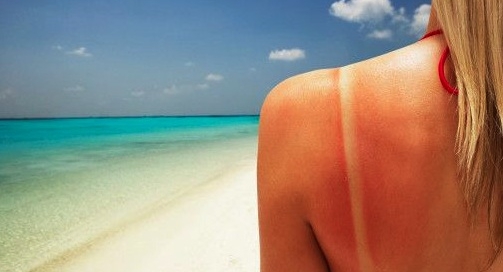 fotoproteccion-solar