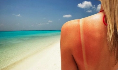 fotoproteccion-solar