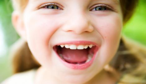 Caries en niños