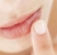 herpes-labial